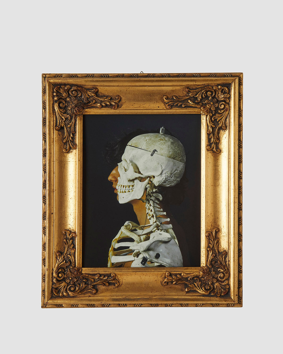 Vivere è Morire. (FRAME)