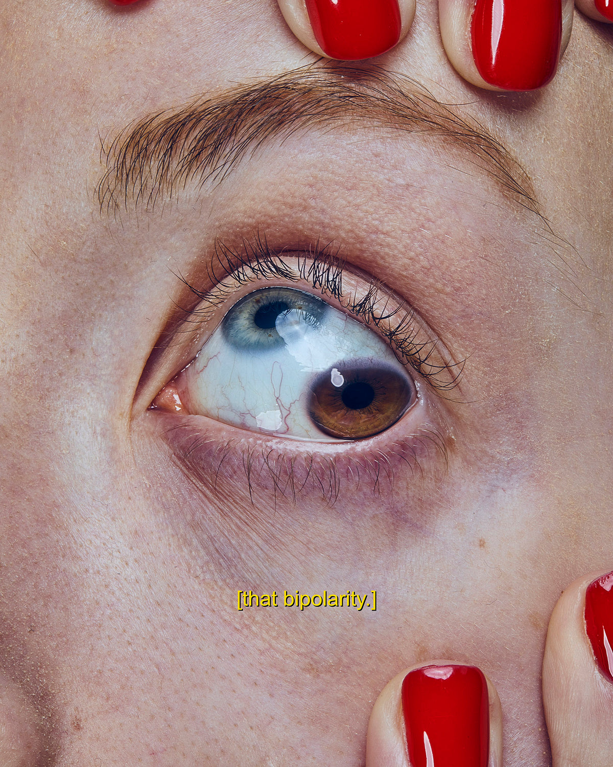 [that bipolarity.]
